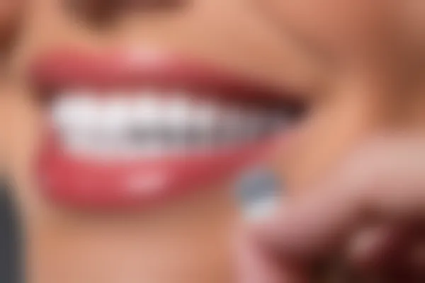 洗牙抛光是否能够有效使牙齿变白？了解洗牙抛光对牙齿美白的真实结果。