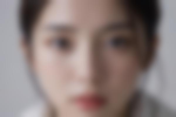 北京潘彦龙眼修复技术好吗？潘彦龙医生精细眼整形价格亲民，0.1mm微创打造妈生眼真香！