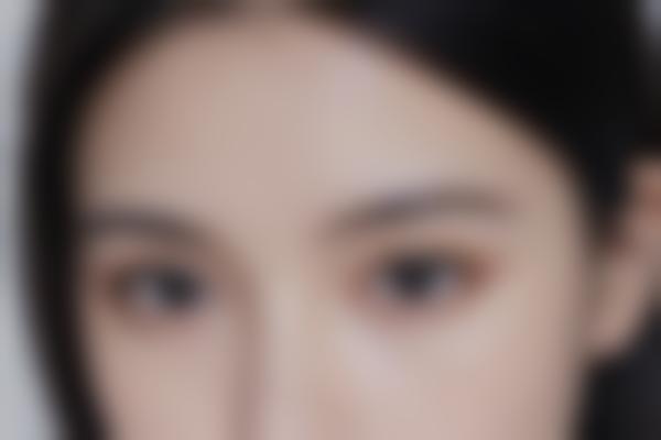 陶俊医生鼻整形技术有哪些优势？