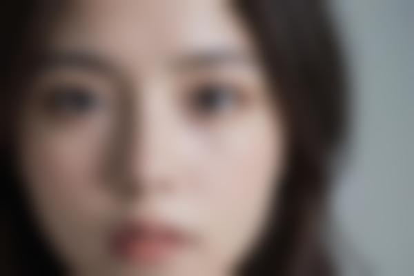 4、许淑菊医生修复自然
