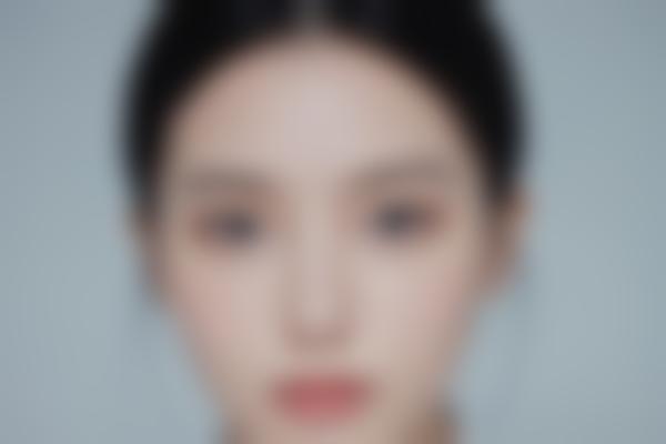 李宜欣医生擅长项目及价格参考