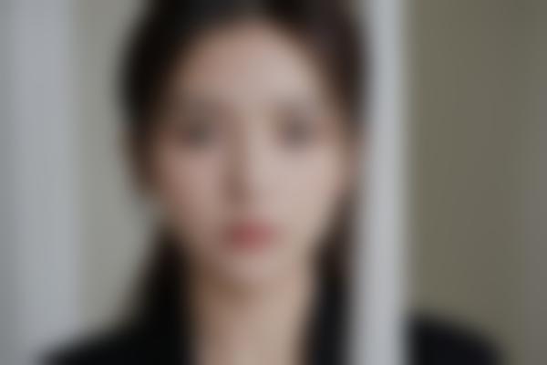 石家庄何晓娅医生鼻综合修复绝了！何晓娅隆鼻价格亲民，自然鼻型雕刻大师！