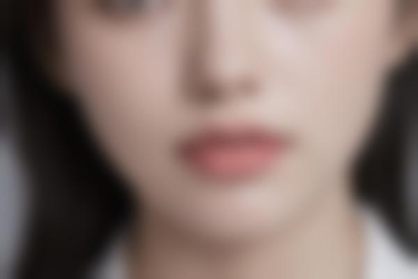 2、林金德脂肪移植让轮廓线条更精致