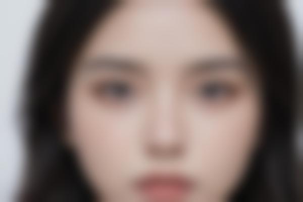 4、术后关怀很省心