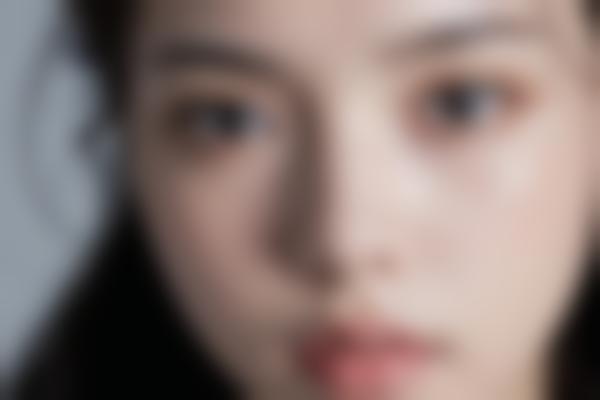 姚明芳医生擅长哪些项目？