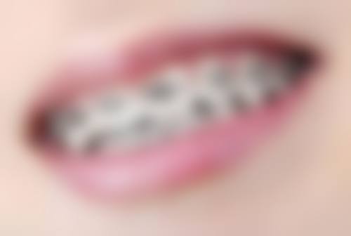 四、手术过程详解