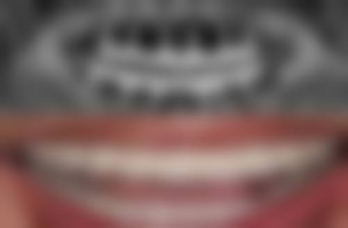 四、医院介绍：鼎植口腔——连锁品牌，专注疑难种牙