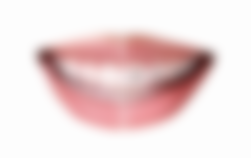 六、半口种植牙的优点与注意事项