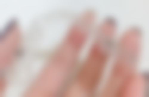 五、半口种植牙的流程与周期