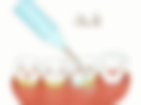 十、总结：60岁老人半口种植牙术后1年分享的启示