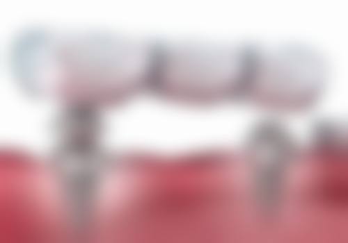 普宁流沙黄仕娜口腔诊所预约挂号方式