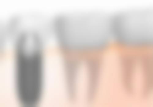 合肥肥东县张清萍口腔特色诊疗项目与技术优势