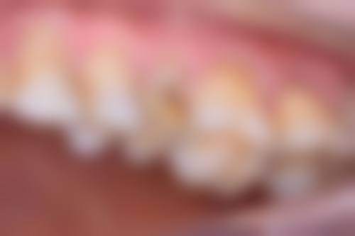 赵恒医生技术优势