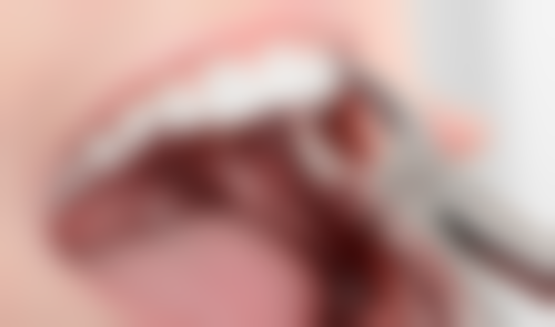 吕佩红医生技术优势