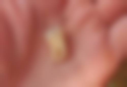 四川省人民医院任旭东医生口碑评价及反馈内容