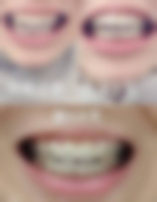 洛阳涧西维乐口腔医院预约挂号方式