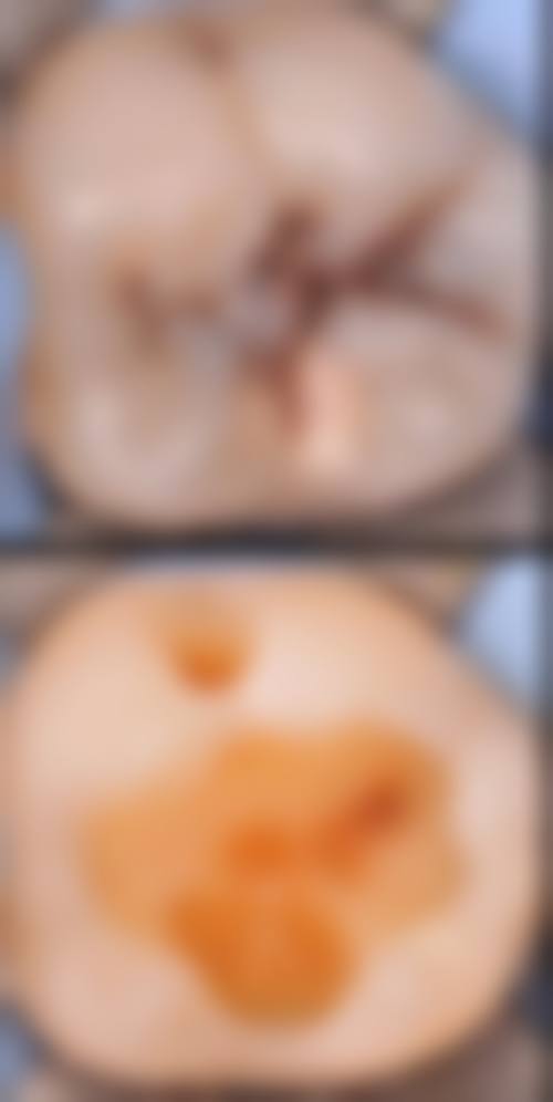 蓝爱仙医生项目收费价格