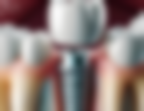 四川省人民医院任旭东医生项目收费价格