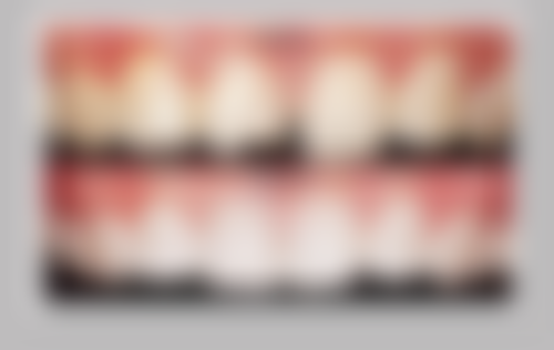 四川省人民医院任旭东医生项目收费价格