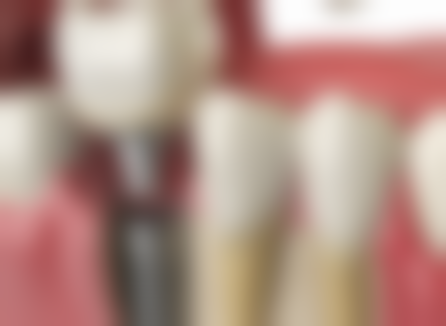 大连甘井子新诺雅口腔诊所预约挂号方式