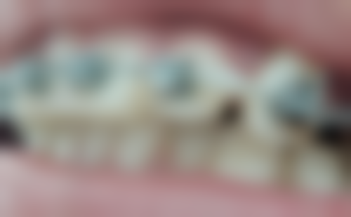 梅一飞商业合作情况