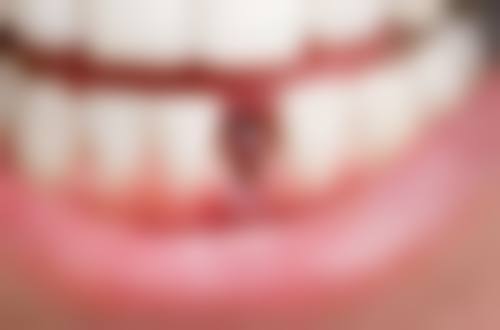 龙口朗朗口腔门诊部预约挂号方式