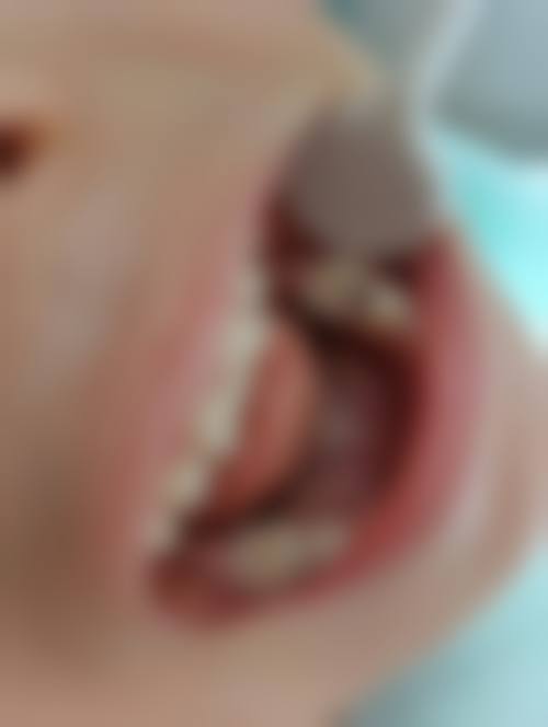 嘉峪关市至正口腔诊所特色诊疗项目与技术优势