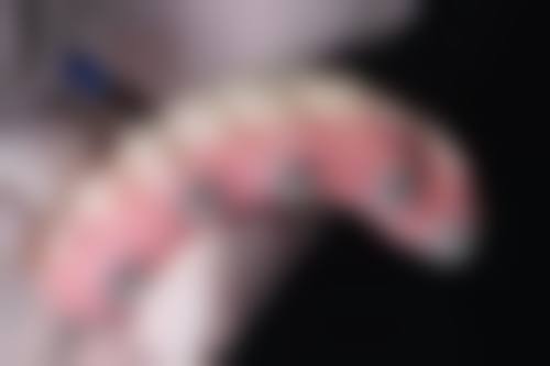 张晓莹医生项目收费价格