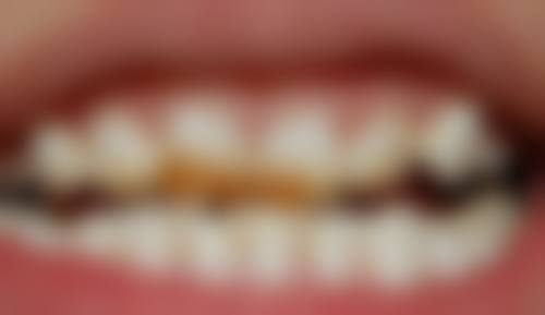 陈晓勇医生预约挂号