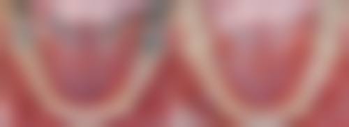 刘清辉医生预约挂号