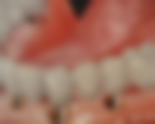 田欢医生（深圳市第二人民医院）预约挂号