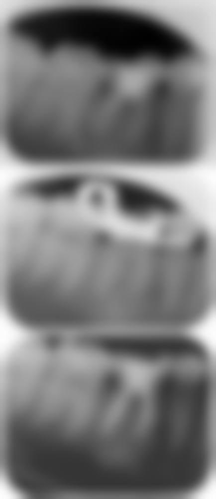 彭跃强医生预约挂号