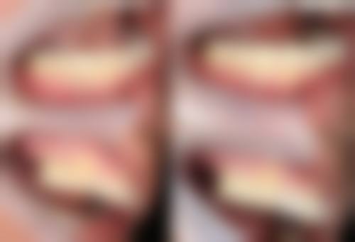 苏维岚医生技术优势