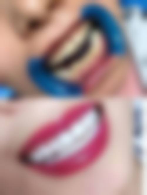 江苏苏州张家港市康锐口腔特色诊疗项目与技术优势