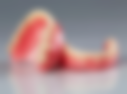 杨镰徽医生项目收费价格