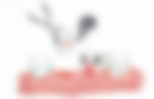 王蓉谈整容心得