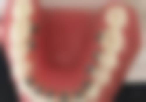 白明海医生项目收费价格