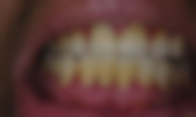 王文清医生技术优势