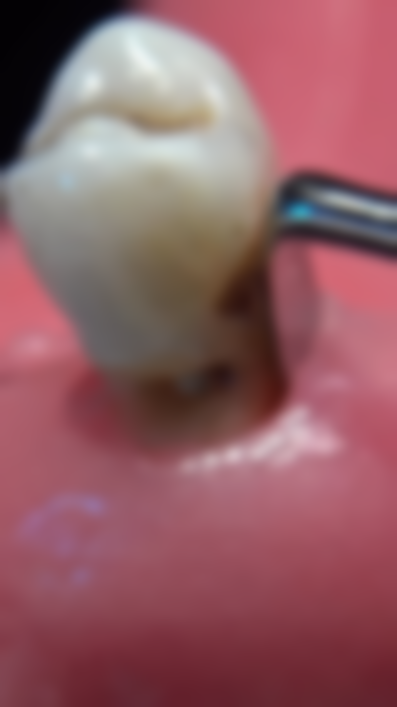 张芳医生技术优势