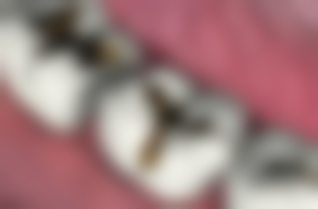 张苹医生技术优势