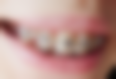 云南昆明宜良县刘荣昌口腔预约挂号方式