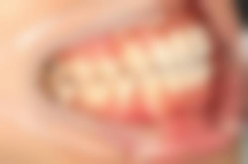 唐新宝医生技术优势