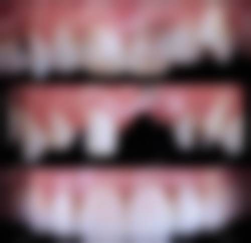 秦洪章医生技术优势