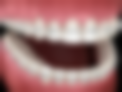 李曙医生预约挂号