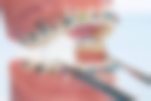 蔡惠医生技术优势