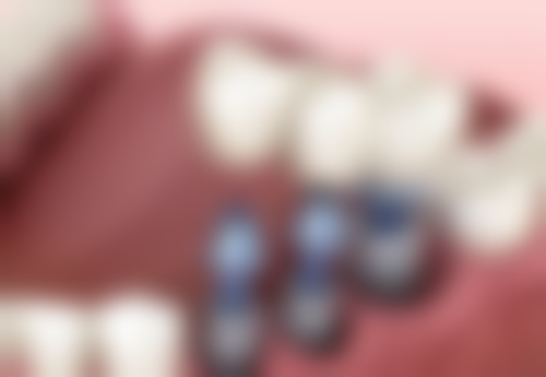 潜江迪伦口腔预约挂号方式