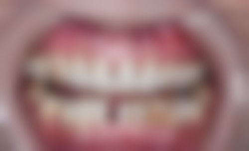 长沙市口腔医院刘代斌医生口碑评价及反馈内容