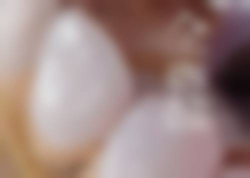 长沙市口腔医院李袁医生技术优势