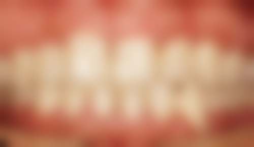 汪宁医生项目收费价格