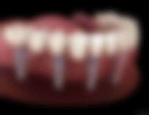 牛薇医生项目收费价格